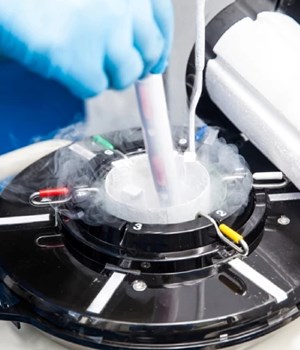 Medical Liquid Nitrogen